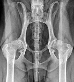 Hip Replacement